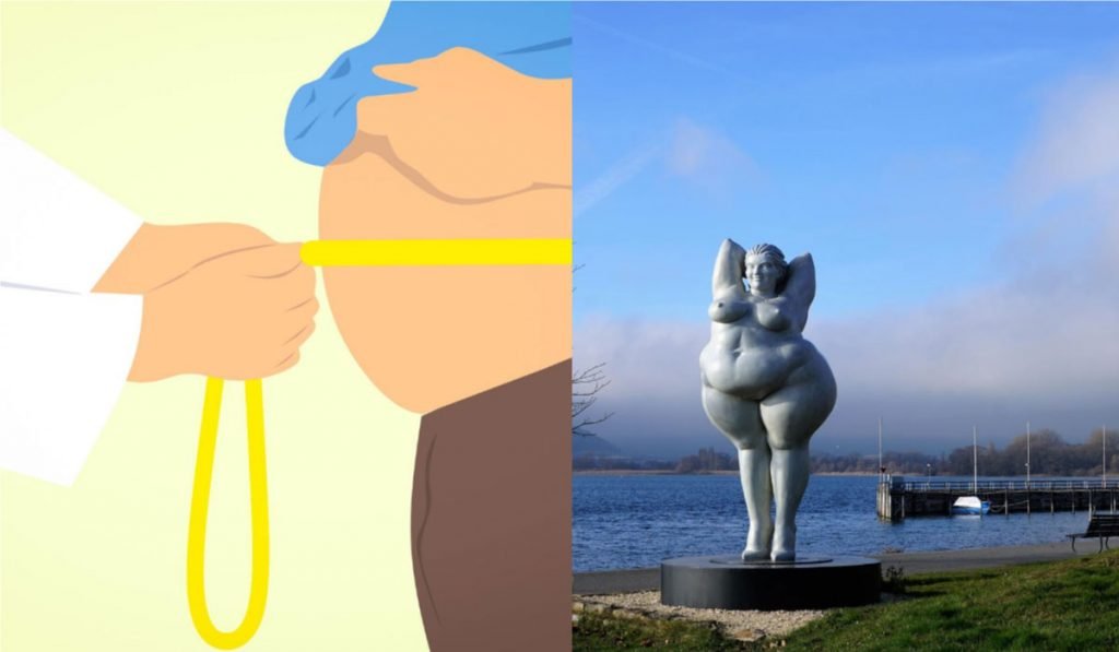 Obesity