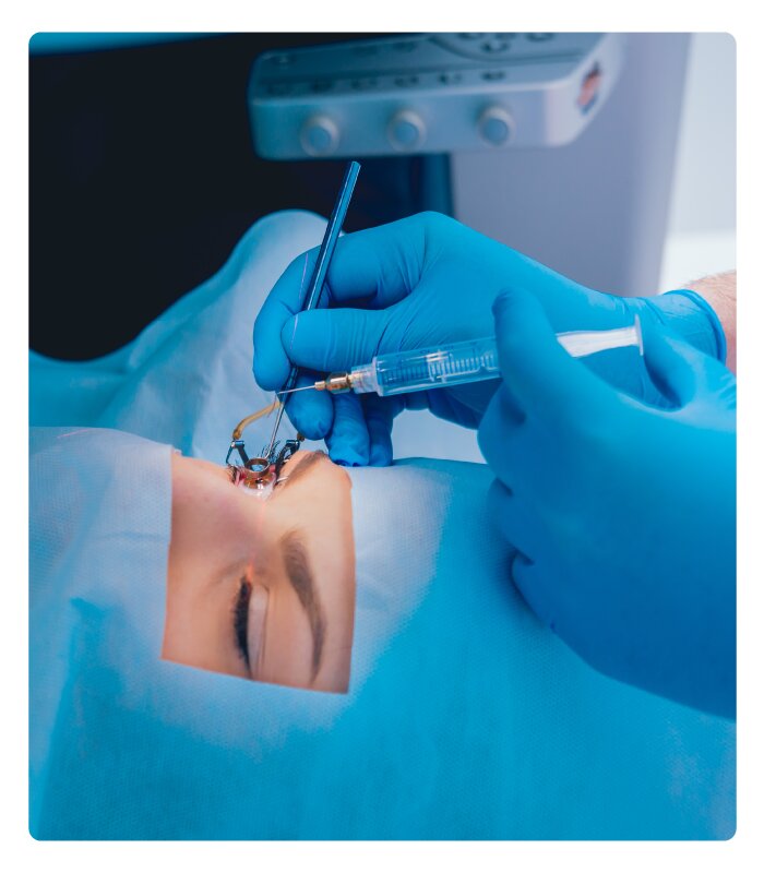 Best Treatment of Laser vision correction