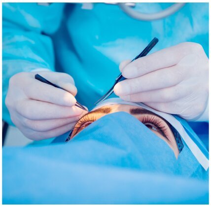 Most Reliable Refractive lens Services